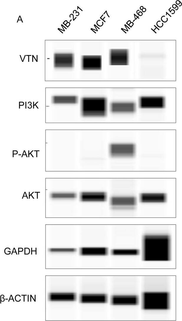 Detection of Human Vitronectin by Western Blot