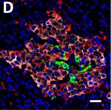 Detection of Human DPP6 by Immunohistochemistry