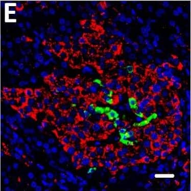 Detection of Human DPP6 by Immunohistochemistry