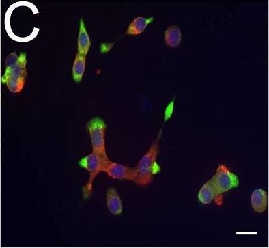 Detection of Human DPP6 by Immunocytochemistry/ Immunofluorescence