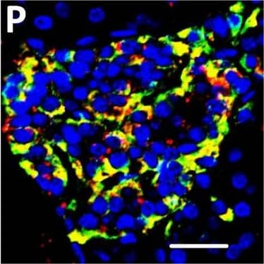Detection of Human DPP6 by Immunohistochemistry