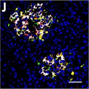Detection of Human DPP6 by Immunohistochemistry