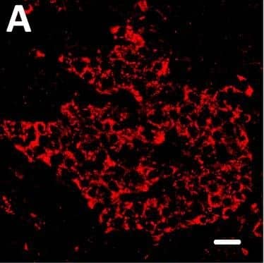 Detection of Human DPP6 by Immunohistochemistry