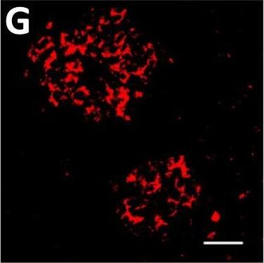 Detection of Human DPP6 by Immunohistochemistry