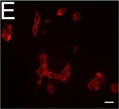 Detection of Human DPP6 by Immunocytochemistry/ Immunofluorescence