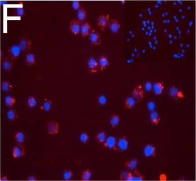 Detection of Human DPP6 by Immunocytochemistry/ Immunofluorescence