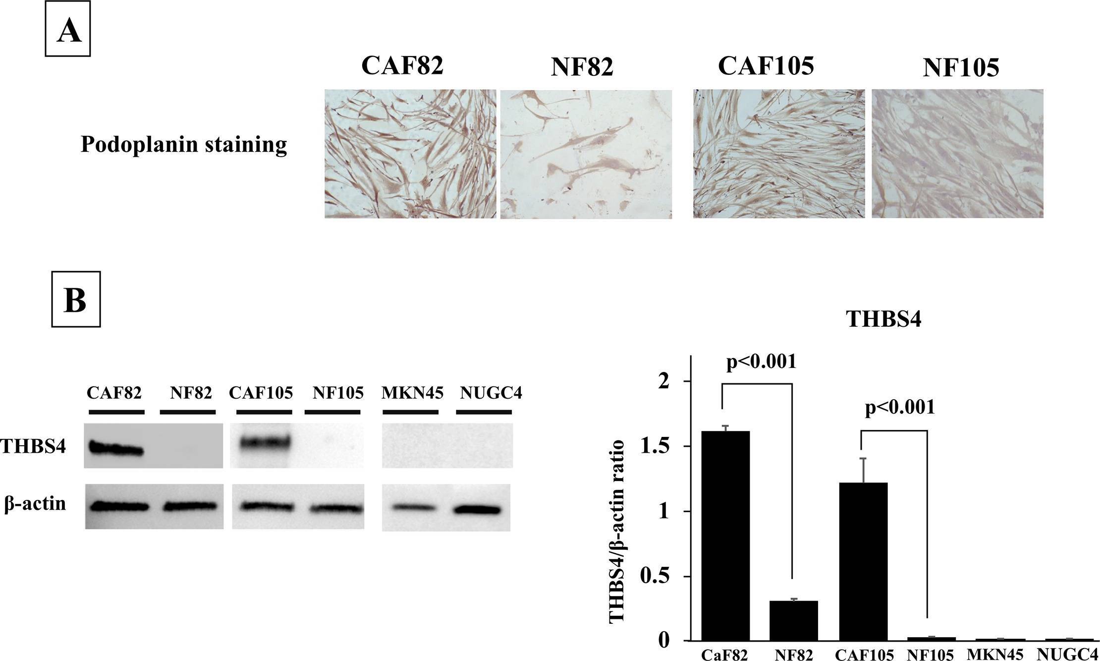 Detection of Thrombospondin-4 by Immunohistochemistry