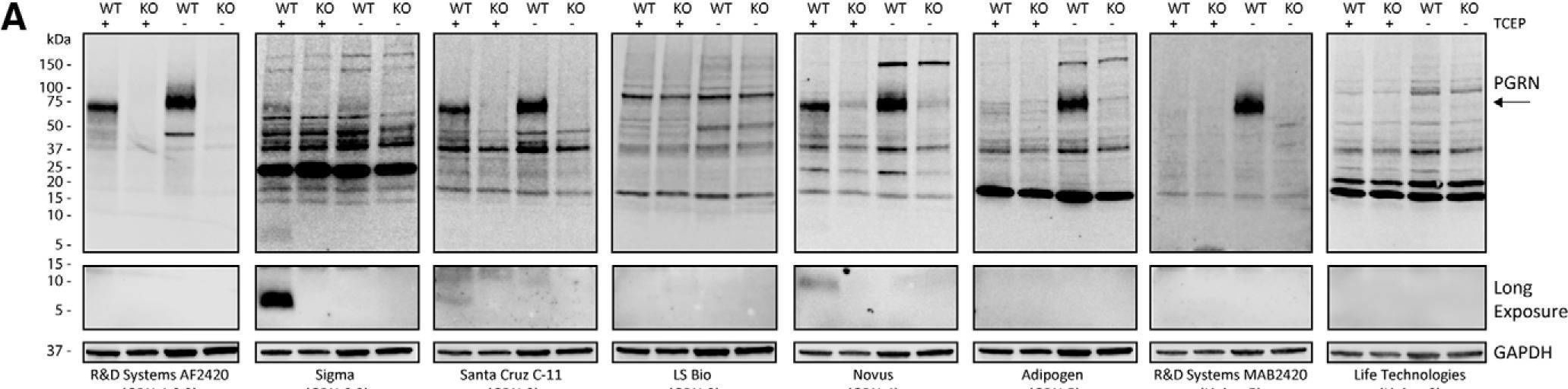 Detection of Human Progranulin/PGRN by Western Blot