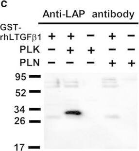 Detection of LAP (TGF-beta 1) by Western Blot