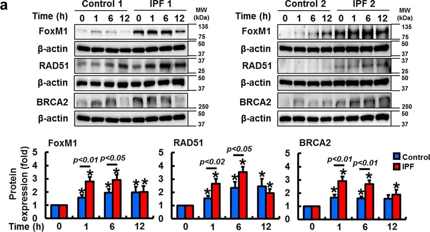 Detection of Human Human BRCA2 Antibody by Western Blot