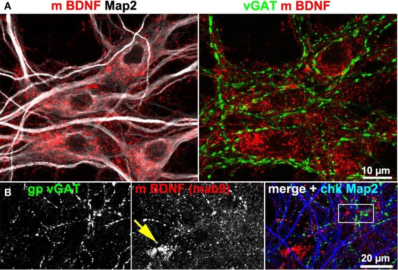 Detection of BDNF by Immunohistochemistry