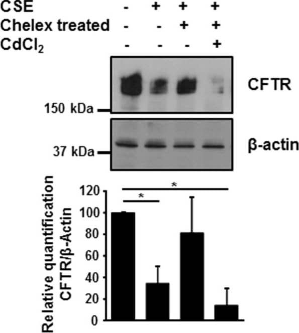 Detection of Human CFTR by Western Blot