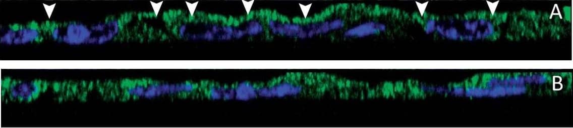Detection of Human CFTR by Immunocytochemistry/Immunofluorescence