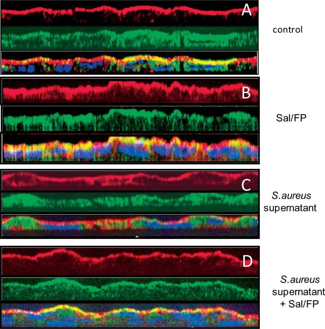Detection of Human CFTR by Immunocytochemistry/Immunofluorescence