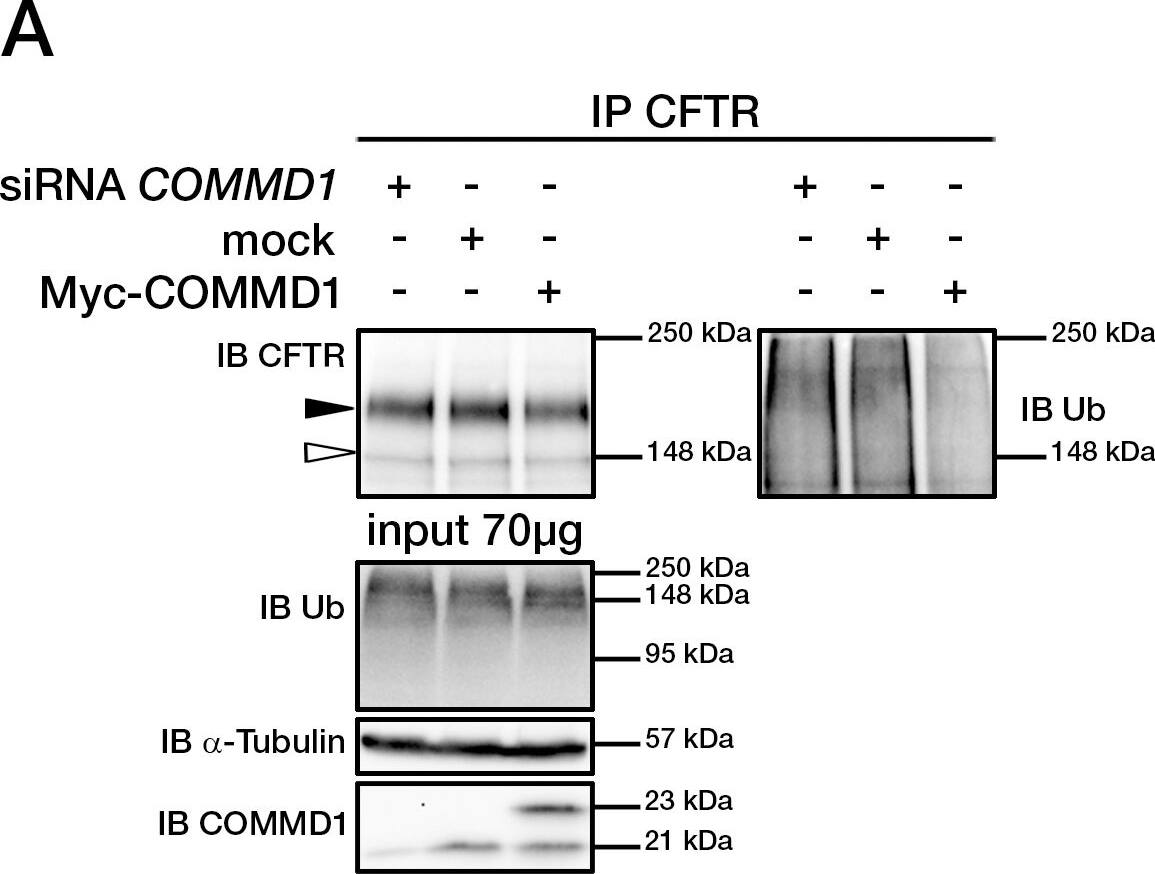 Detection of Human CFTR by Western Blot