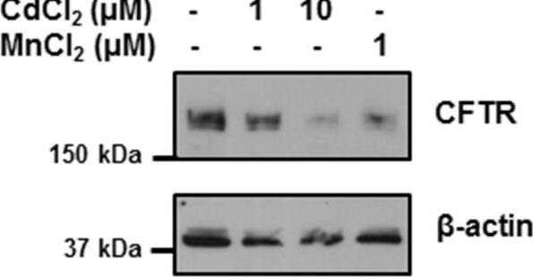 Detection of Human CFTR by Western Blot