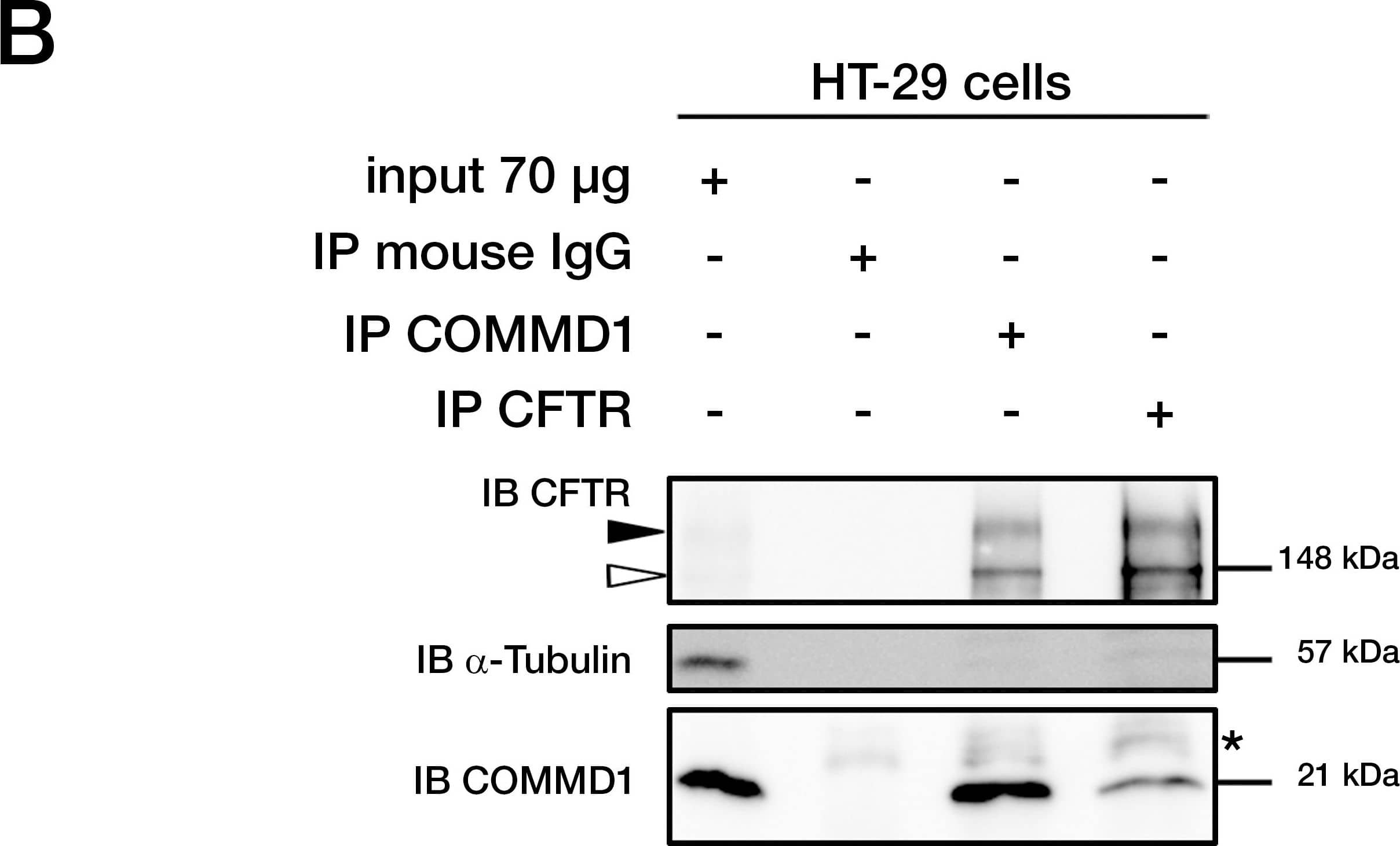 Detection of Human CFTR by Immunoprecipitation