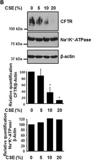 Detection of Human CFTR by Western Blot