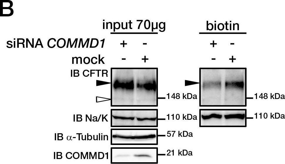 Detection of CFTR by Western Blot