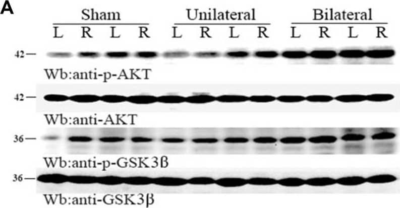 Detection of Mouse GSK-3 beta by Western Blot