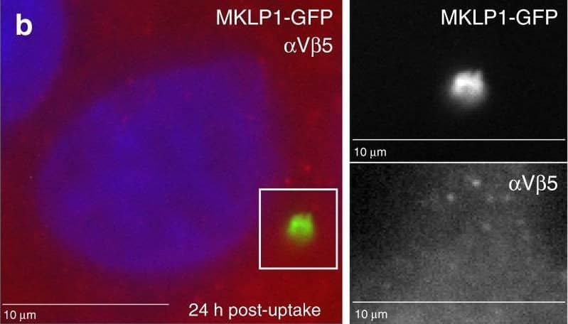 Detection of Human Integrin alpha V beta 5 by Immunocytochemistry/Immunofluorescence