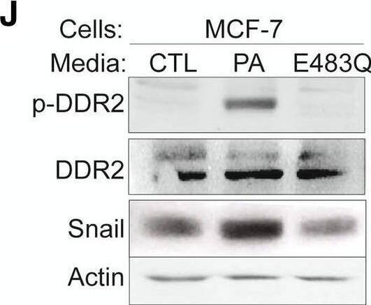 Detection of Phospho-DDR1/DDR2 (DDR1 Y796, DDR2 Y740) by Western Blot
