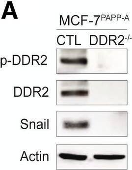 Detection of Phospho-DDR1/DDR2 (DDR1 Y796, DDR2 Y740) by Western Blot