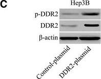 Detection of Phospho-DDR1/DDR2 (DDR1 Y796, DDR2 Y740) by Western Blot