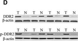 Detection of Phospho-DDR1/DDR2 (DDR1 Y796, DDR2 Y740) by Western Blot