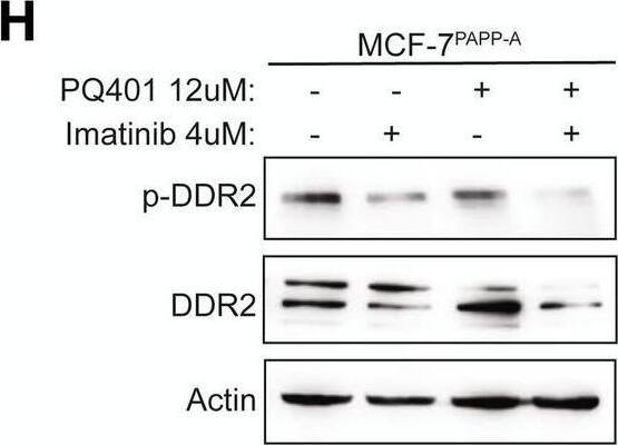 Detection of Phospho-DDR1/DDR2 (DDR1 Y796, DDR2 Y740) by Western Blot