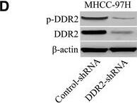 Detection of Phospho-DDR1/DDR2 (DDR1 Y796, DDR2 Y740) by Western Blot