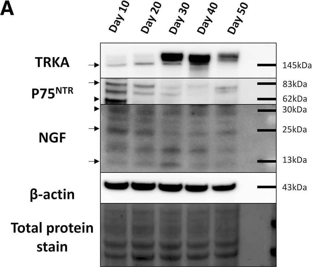 Detection of beta-NGF by Western Blot