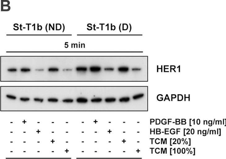 Detection of HB-EGF by Western Blot