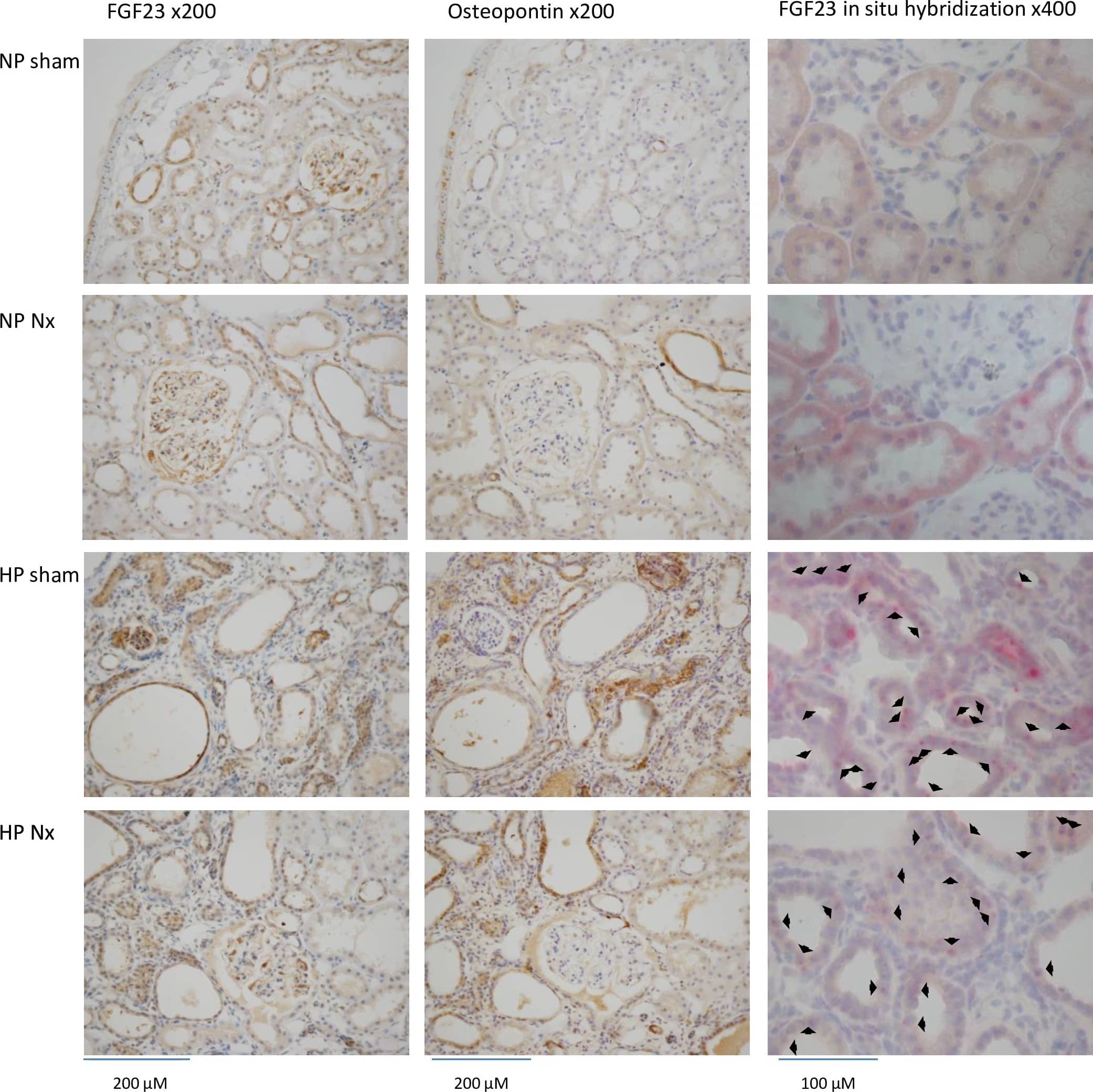 Detection of Rat FGF-23 by Immunohistochemistry