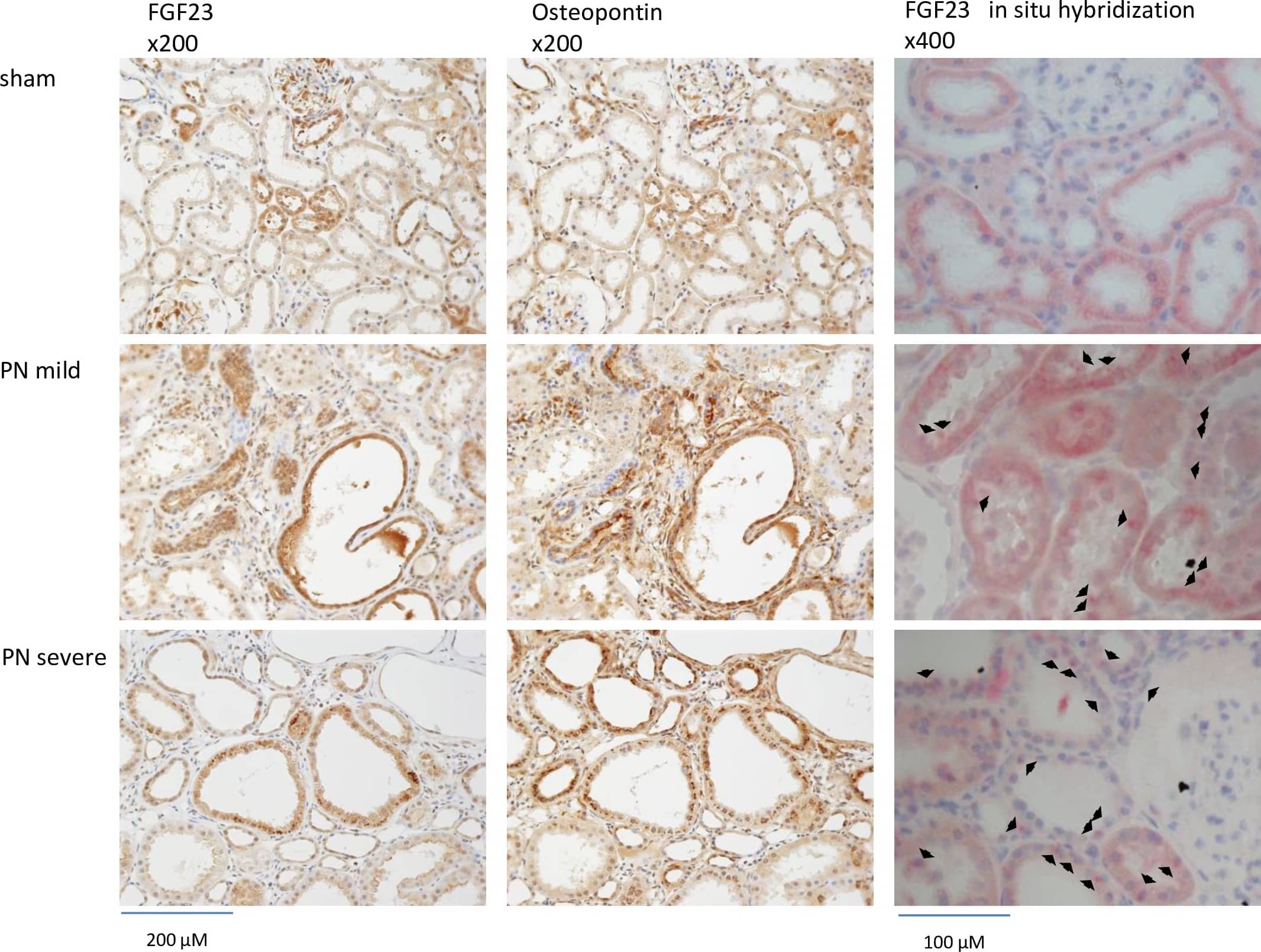 Detection of Rat FGF-23 by Immunohistochemistry