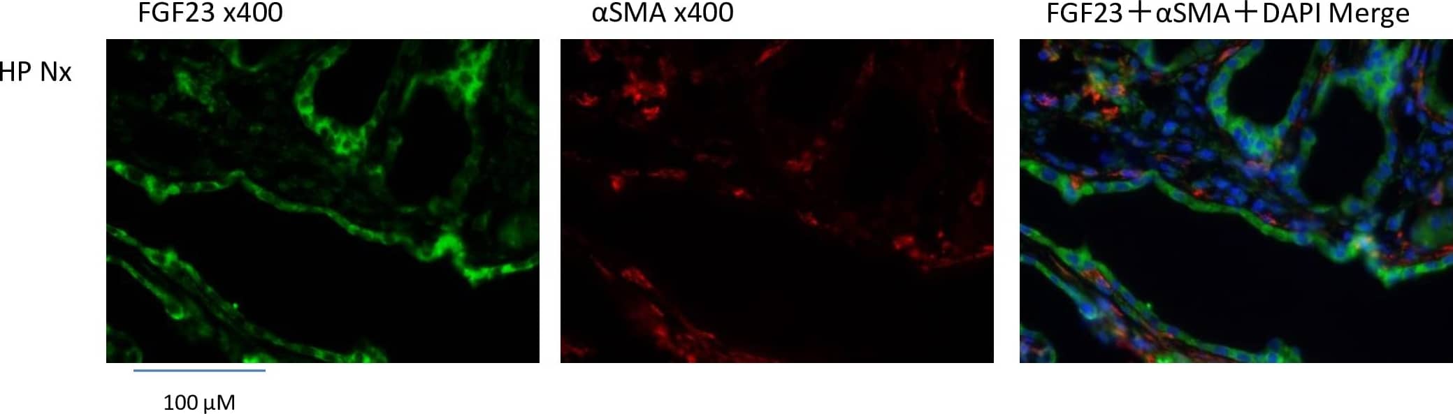 Detection of Rat FGF-23 by Immunohistochemistry