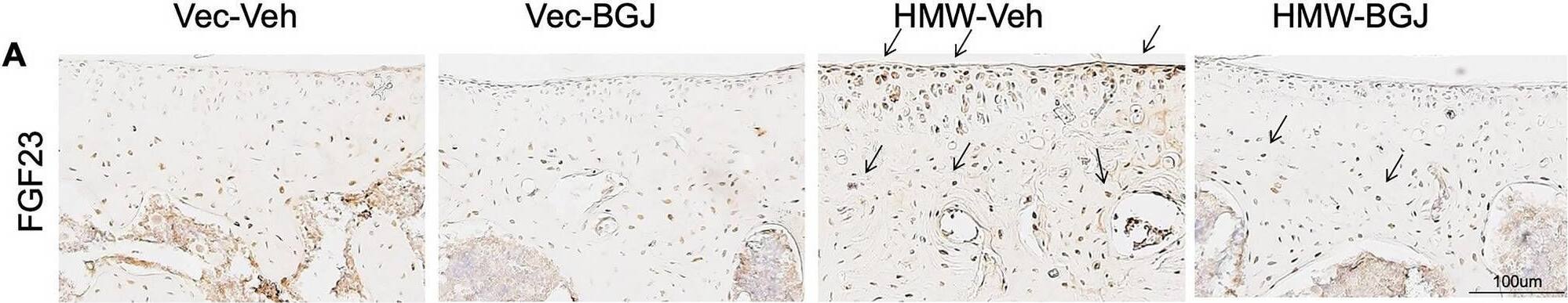 Detection of FGF-23 by Immunohistochemistry
