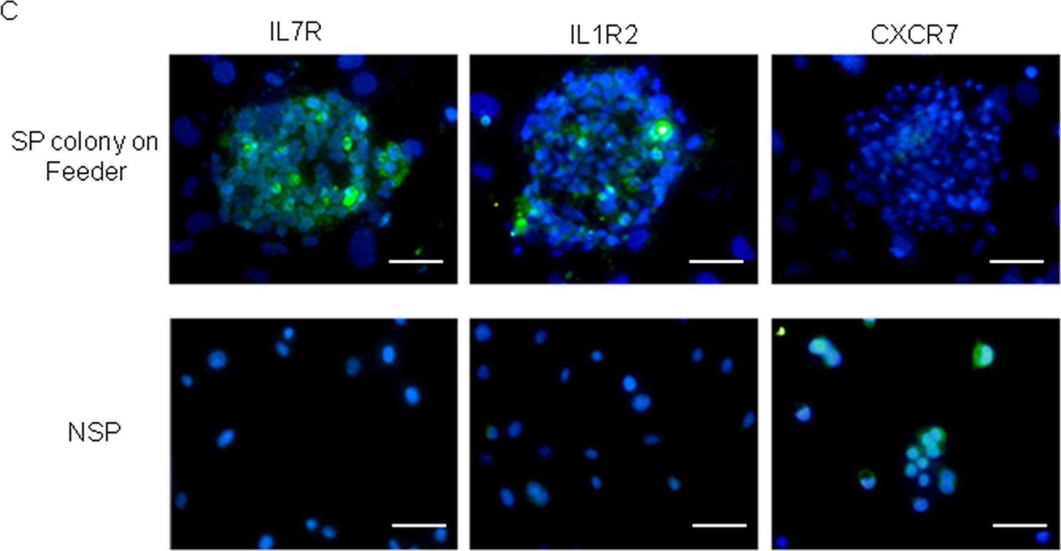 Detection of Human IL-1 RII by Immunocytochemistry/ Immunofluorescence