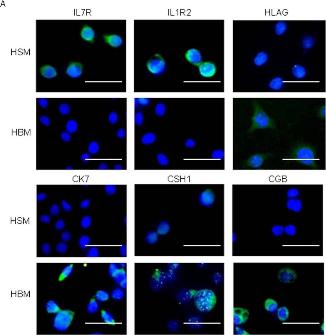 Detection of Human IL-1 RII by Immunocytochemistry/ Immunofluorescence