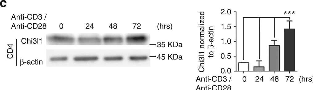 Detection of Chitinase 3-like 1/YKL-40 by Western Blot