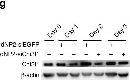 Detection of Chitinase 3-like 1/YKL-40 by Western Blot