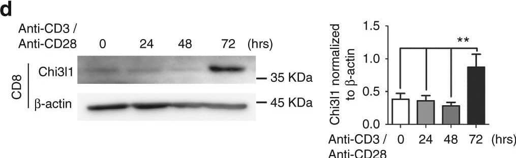 Detection of Chitinase 3-like 1/YKL-40 by Western Blot