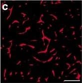 Detection of Human PLGF by Block/Neutralize