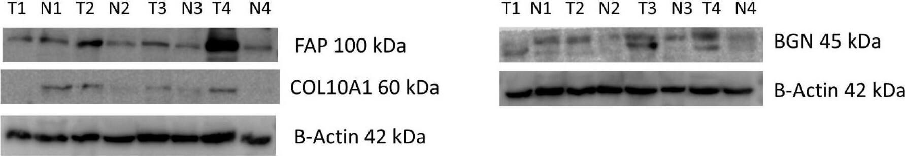 Detection of Human Biglycan by Western Blot