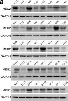 Detection of PTP-MEG2 by Western Blot
