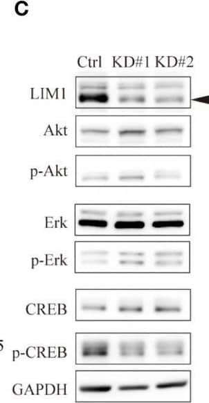 Detection of Human LIM1 by Western Blot