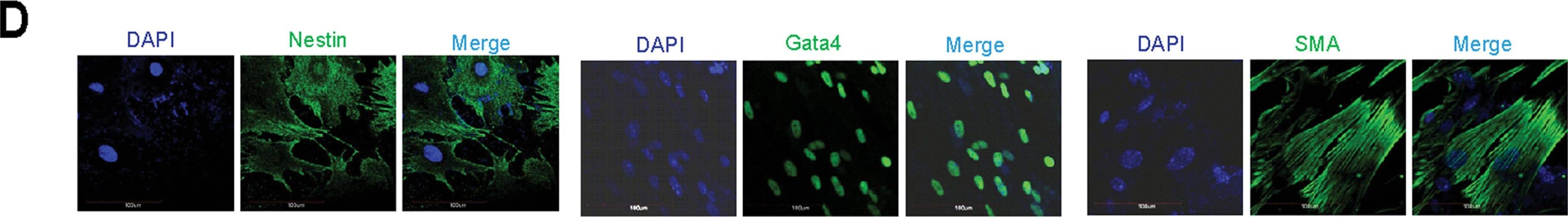 Detection of Mouse Nestin by Immunocytochemistry/Immunofluorescence