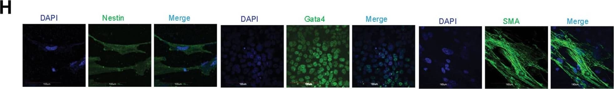 Detection of Nestin by Immunocytochemistry/ Immunofluorescence