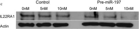 Detection of Human IL-22R alpha 1 by Western Blot