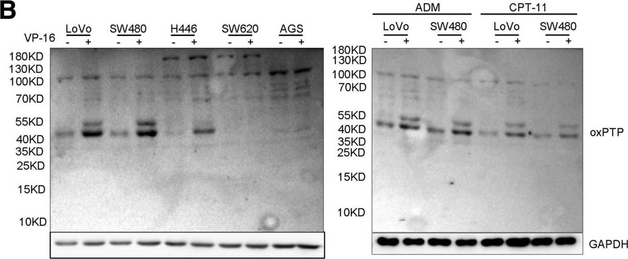Detection of Human Oxidized PTP Active Site by Western Blot